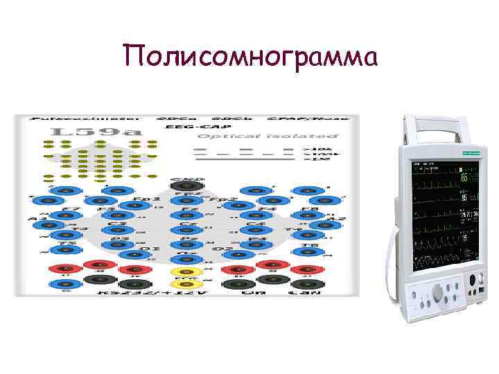 Полисомнограмма 