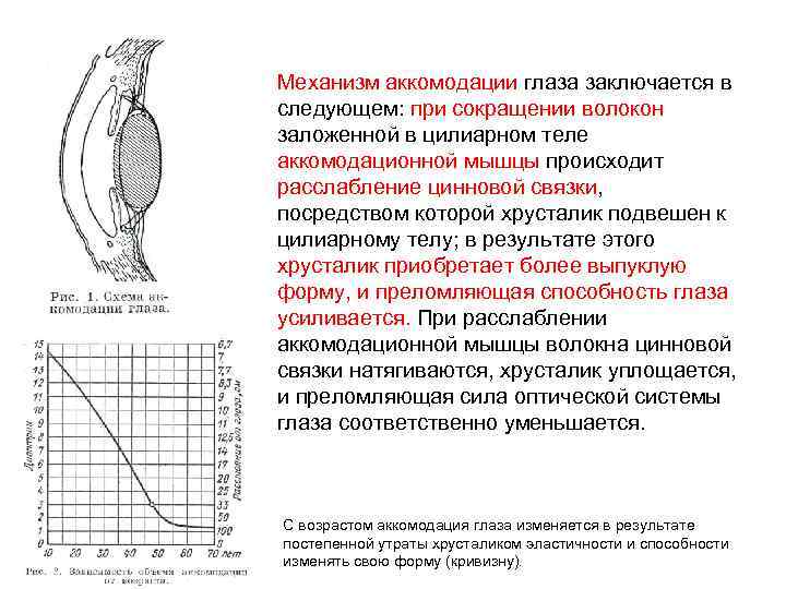 Механизм аккомодации глаза заключается в следующем: при сокращении волокон заложенной в цилиарном теле аккомодационной