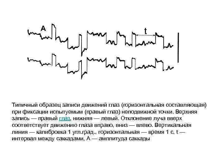 Типичный образец записи движений глаз (горизонтальная составляющая) при фиксации испытуемым (правый глаз) неподвижной точки.