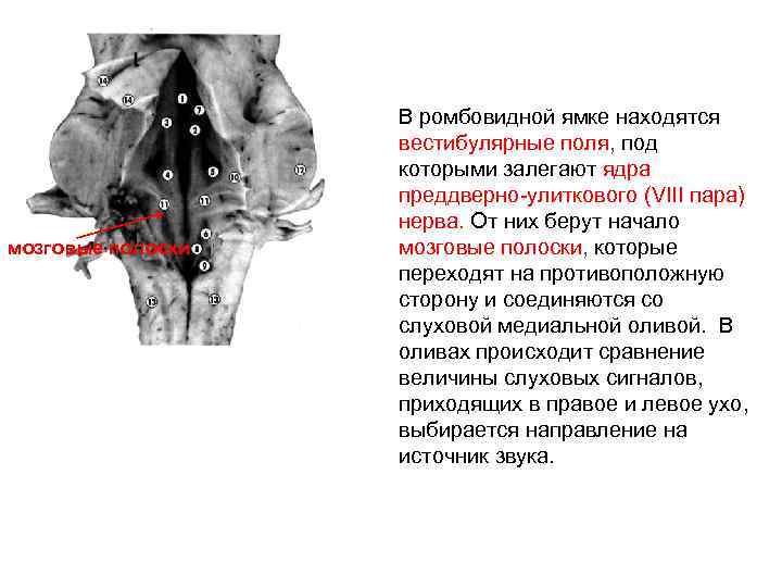 мозговые полоски В ромбовидной ямке находятся вестибулярные поля, под которыми залегают ядра преддверно-улиткового (VIII