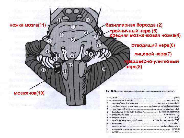 ножка мозга(11) базиллярная борозда (2) тройничный нерв (5) средняя мозжечковая ножка(4) отводящий нерв(6) лицевой