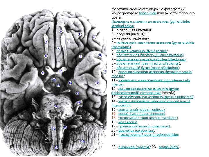 Морфологические структуры на фотографии макропрепарата базальной поверхности головного мозга. Продольные глазничные извилины (gyri orbitales