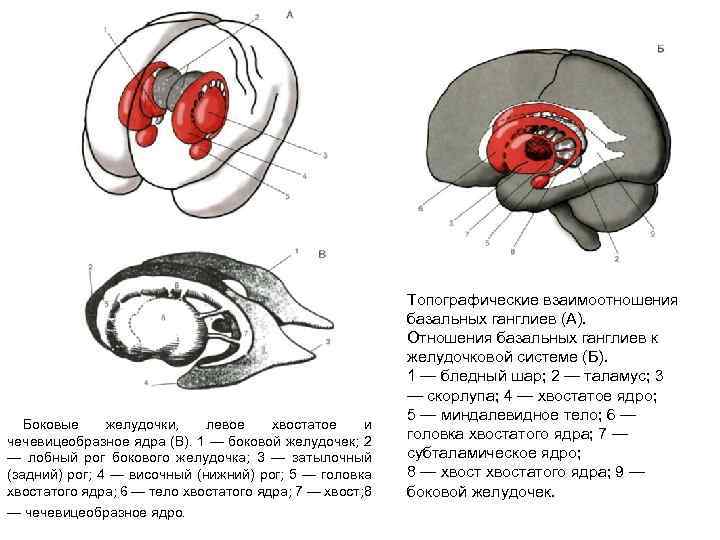 Боковые желудочки, левое хвостатое и чечевицеобразное ядра (В). 1 — боковой желудочек; 2 —