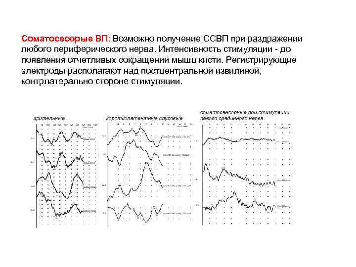 Соматосесорые ВП: Возможно получение ССВП при раздражении любого периферического нерва. Интенсивность стимуляции - до