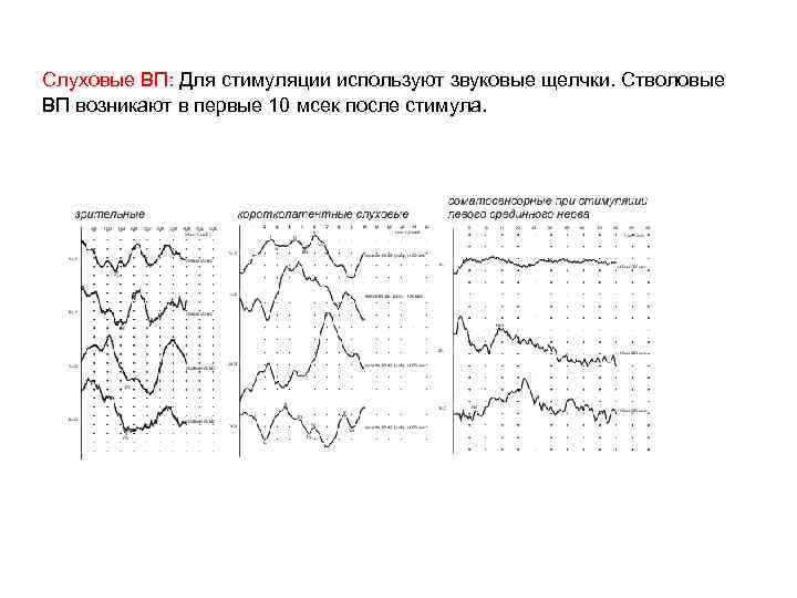 Слуховые ВП: Для стимуляции используют звуковые щелчки. Стволовые ВП возникают в первые 10 мсек
