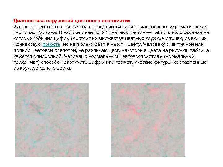 Диагностика нарушений цветового восприятия Характер цветового восприятия определяется на специальных полихроматических таблицах Рабкина. В