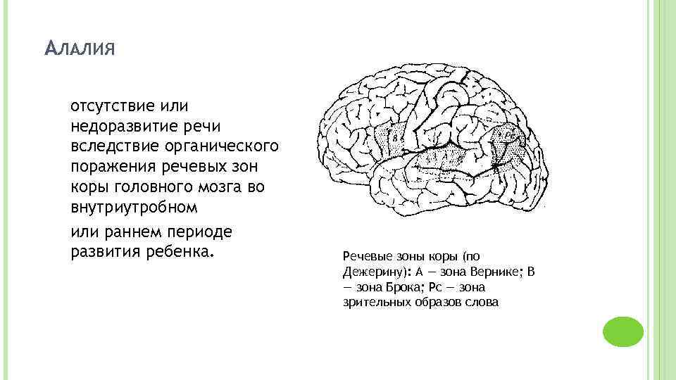 Причины сенсорно моторной алалии