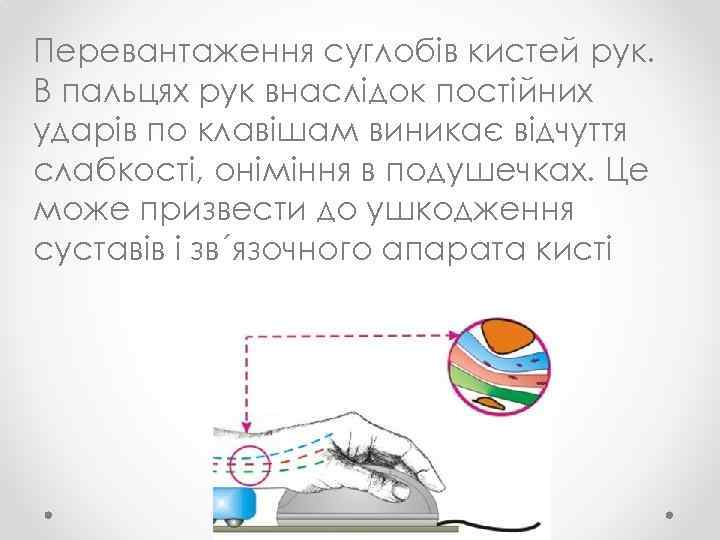 Перевантаження суглобів кистей рук. В пальцях рук внаслідок постійних ударів по клавішам виникає відчуття