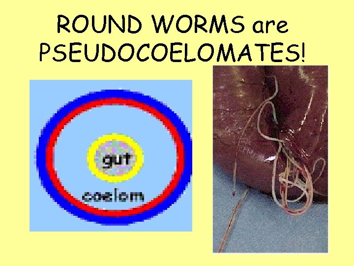 ROUND WORMS are PSEUDOCOELOMATES! 