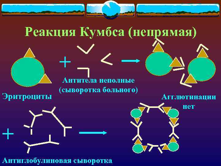 Реакция Кумбса (непрямая) + Эритроциты Антитела неполные (сыворотка больного) + Антиглобулиновая сыворотка Агглютинации нет