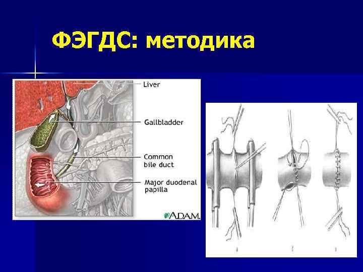 ФЭГДС: методика 