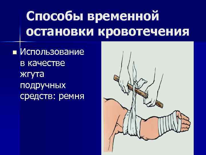 Способы временной остановки кровотечения n Использование в качестве жгута подручных средств: ремня 