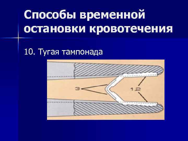 Какие признаки классификации кровотечений существуют закончите схему