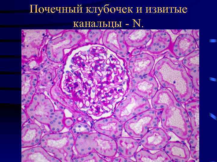 Почечный клубочек и извитые канальцы - N. 