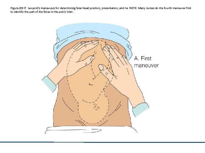 Figure 23– 7 Leopold’s maneuvers for determining fetal head position, presentation, and lie. NOTE: