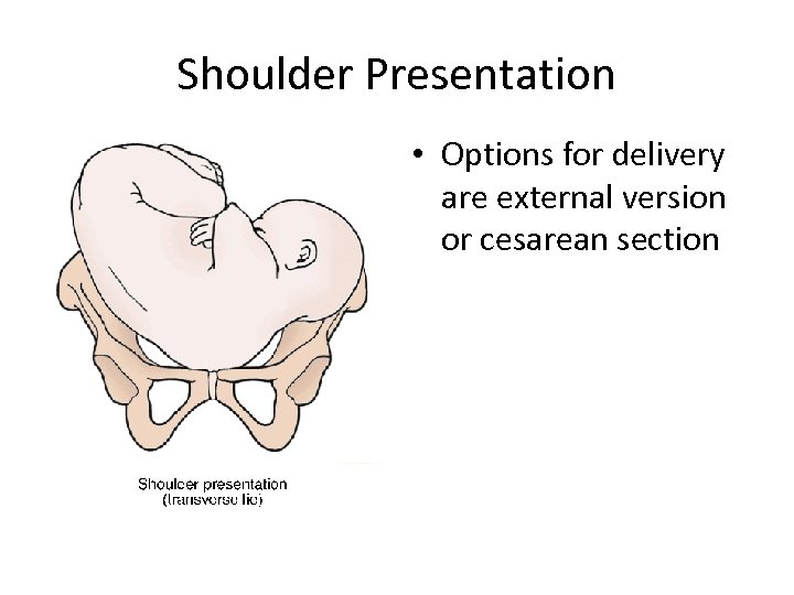 another name for shoulder presentation