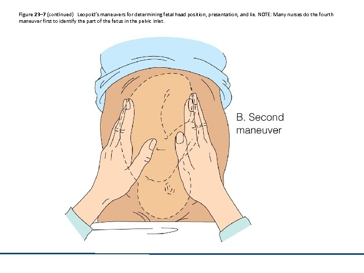 Figure 23– 7 (continued) Leopold’s maneuvers for determining fetal head position, presentation, and lie.