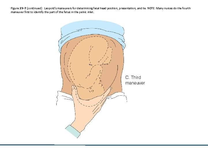 Figure 23– 7 (continued) Leopold’s maneuvers for determining fetal head position, presentation, and lie.