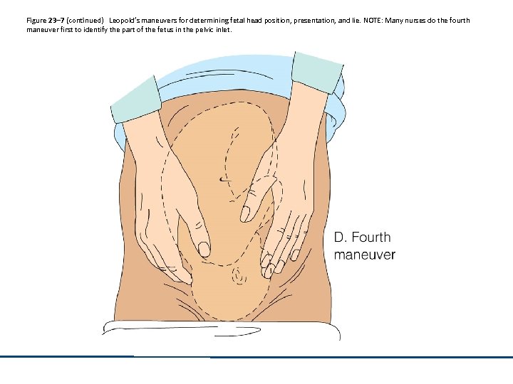 Figure 23– 7 (continued) Leopold’s maneuvers for determining fetal head position, presentation, and lie.