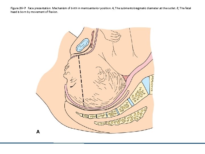 Figure 26– 7 Face presentation. Mechanism of birth in mentoanterior position. A, The submentobregmatic