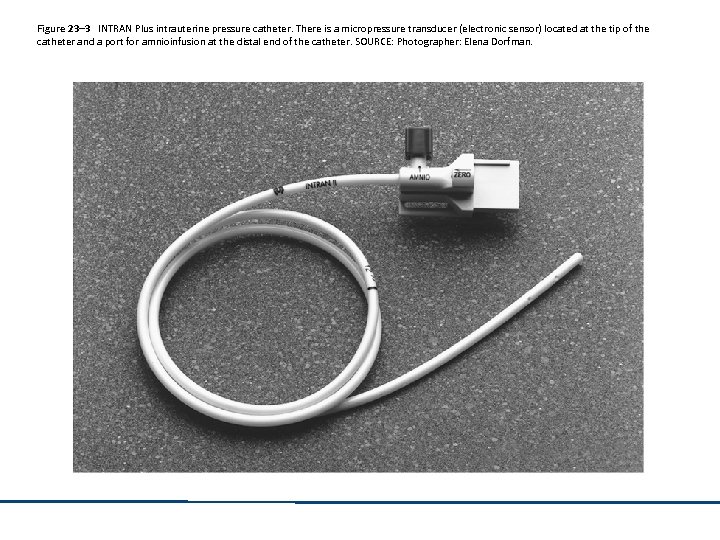 Figure 23– 3 INTRAN Plus intrauterine pressure catheter. There is a micropressure transducer (electronic