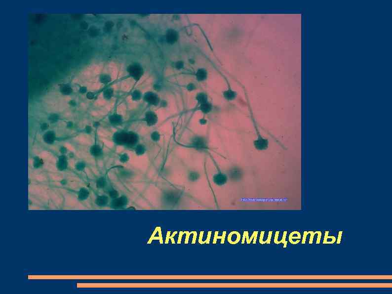 Актиномицеты 