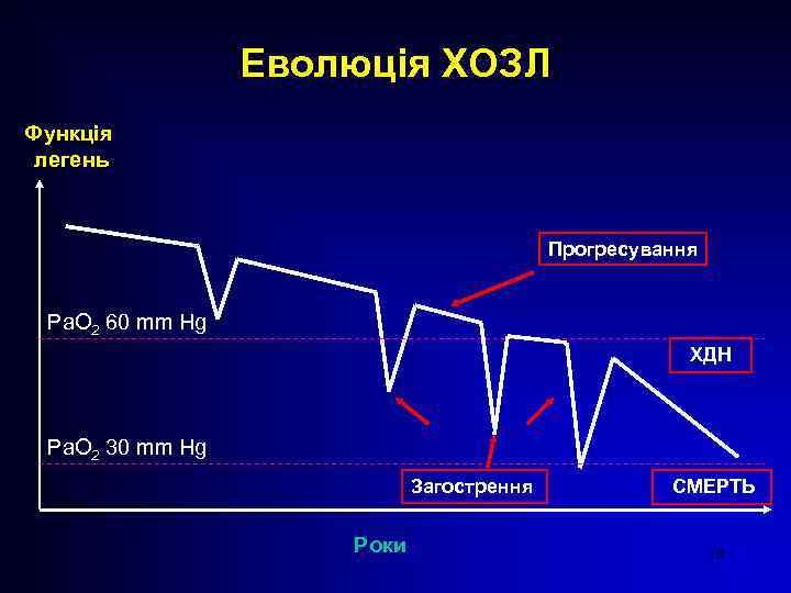 Еволюція ХОЗЛ Функція легень Прогресування Ра. О 2 60 mm Hg ХДН Ра. О