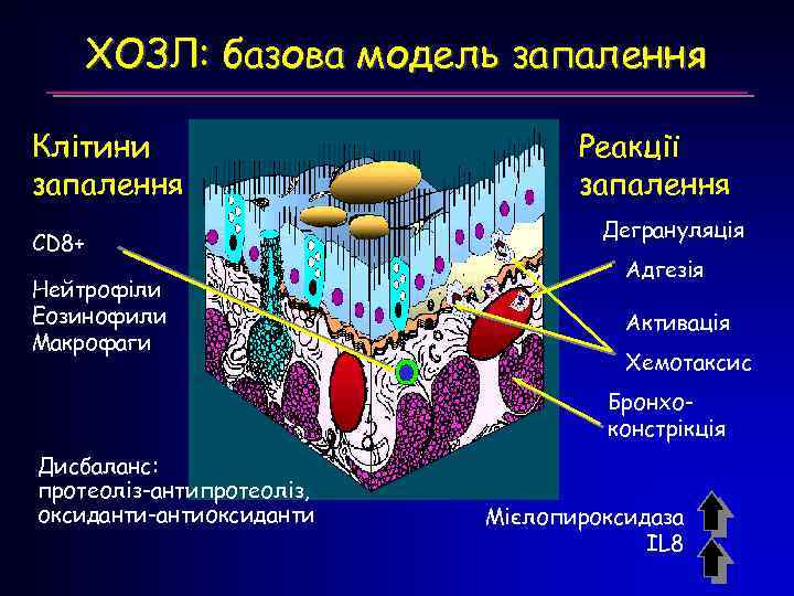 ХОЗЛ: базова модель запалення Клітини запалення CD 8+ Нейтрофіли Еозинофили Макрофаги Реакції запалення Дегрануляція