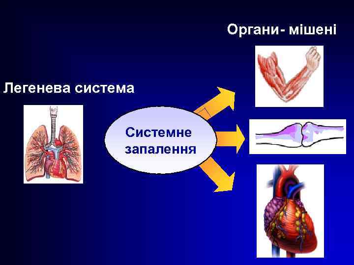 Органи- мішені Легенева система Системне запалення 42 