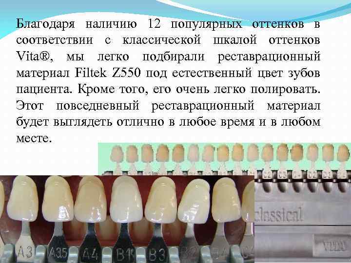 Благодаря наличию 12 популярных оттенков в соответствии с классической шкалой оттенков Vita®, мы легко