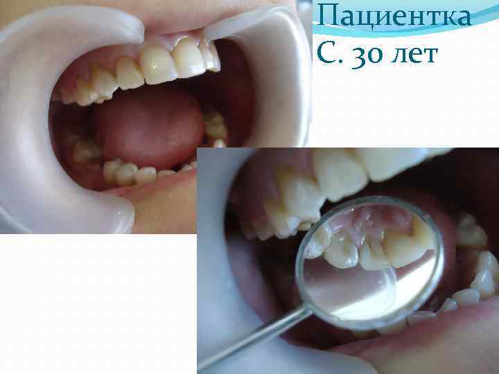 Пациентка С. 30 лет 