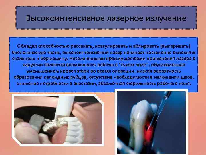 Высокоинтенсивное лазерное излучение Обладая способностью рассекать, коагулировать и аблировать (выпаривать) биологическую ткань, высокоинтенсивный лазер
