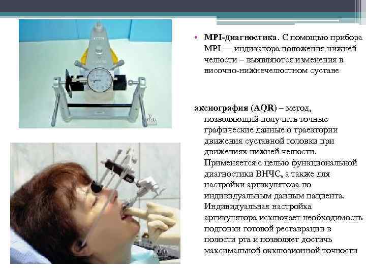  • MPI-диагностика. С помощью прибора MPI — индикатора положения нижней челюсти – выявляются