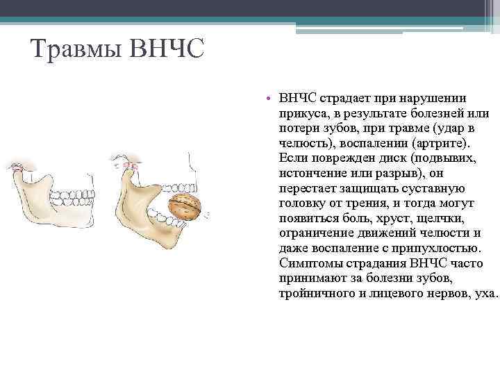 Травмы ВНЧС • ВНЧС страдает при нарушении прикуса, в результате болезней или потери зубов,