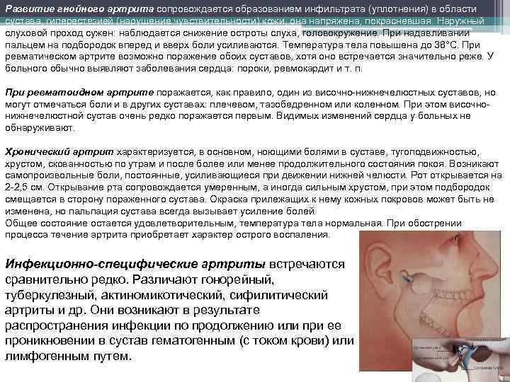 Развитие гнойного артрита сопровождается образованием инфильтрата (уплотнения) в области сустава, гиперестезией (нарушение чувствительности) кожи,