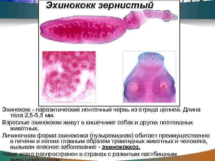 Эхинококк зернистый Эхинококк - паразитический ленточный червь из отряда цепней. Длина тела 2, 5