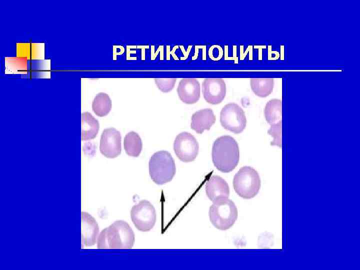 РЕТИКУЛОЦИТЫ 