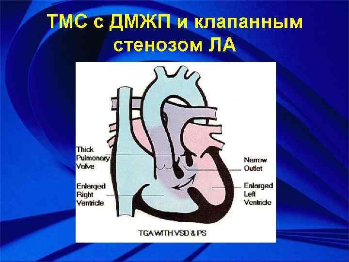 Афо сердечно сосудистой системы у новорожденных презентация