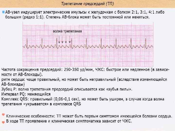 Трепетание предсердий карта вызова