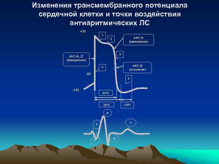 Изменения трансмембранного потенциала сердечной клетки и точки воздействия антиаритмических ЛС +30 1 ААП IA