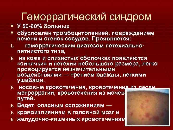 Геморрагический синдром § У 50 -60% больных § обусловлен тромбоцитопенией, повреждением ь ь ь