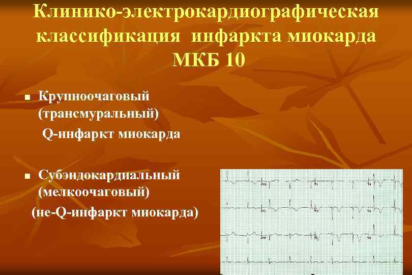 Клинико-электрокардиографическая классификация инфаркта миокарда МКБ 10 n n Крупноочаговый (трансмуральный) Q-инфаркт миокарда Субэндокардиальный (мелкоочаговый)