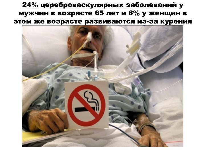 24% цереброваскулярных заболеваний у мужчин в возрасте 65 лет и 6% у женщин в