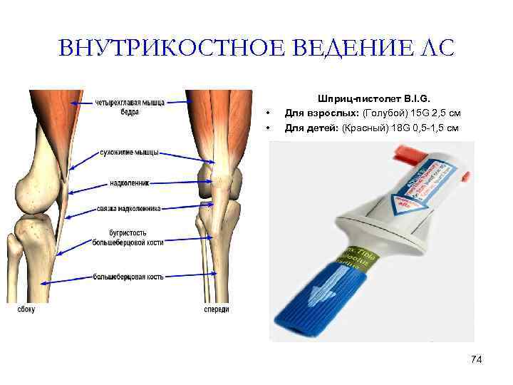 ВНУТРИКОСТНОЕ ВЕДЕНИЕ ЛС • • Шприц-пистолет B. I. G. Для взрослых: (Голубой) 15 G