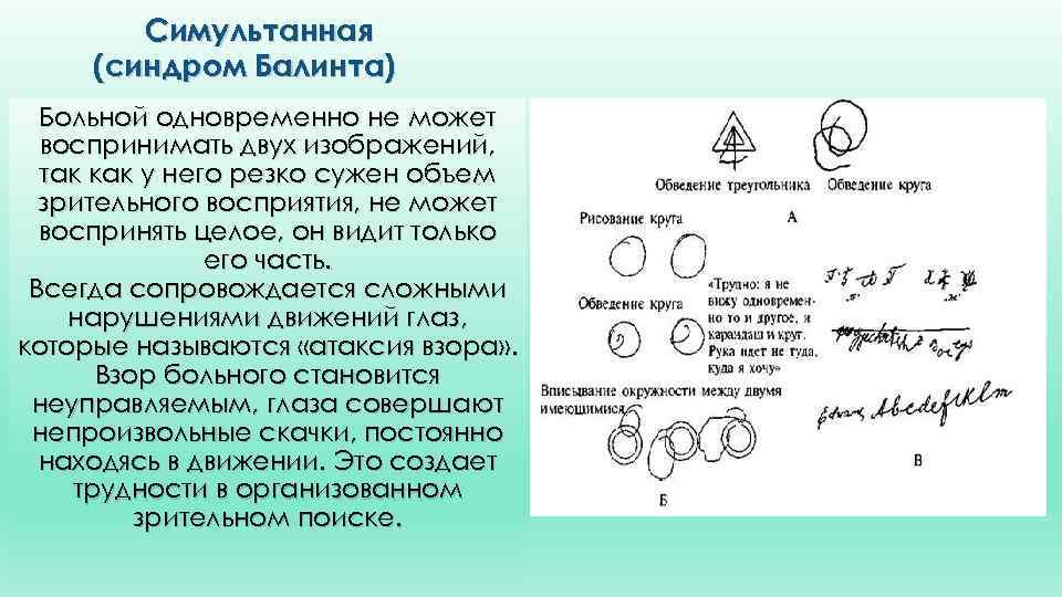 Симультанная (синдром Балинта) Больной одновременно не может воспринимать двух изображений, так как у него