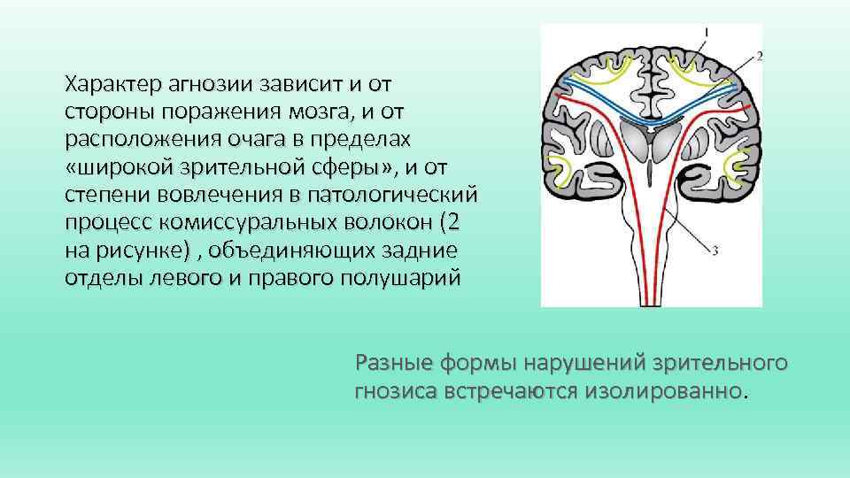 Характер агнозии зависит и от стороны поражения мозга, и от расположения очага в пределах
