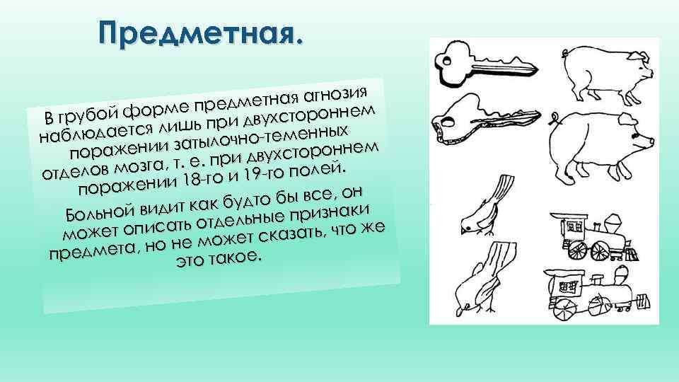 Предметная. я етная агнози едм й форме пр и двухстороннем В грубо пр дается