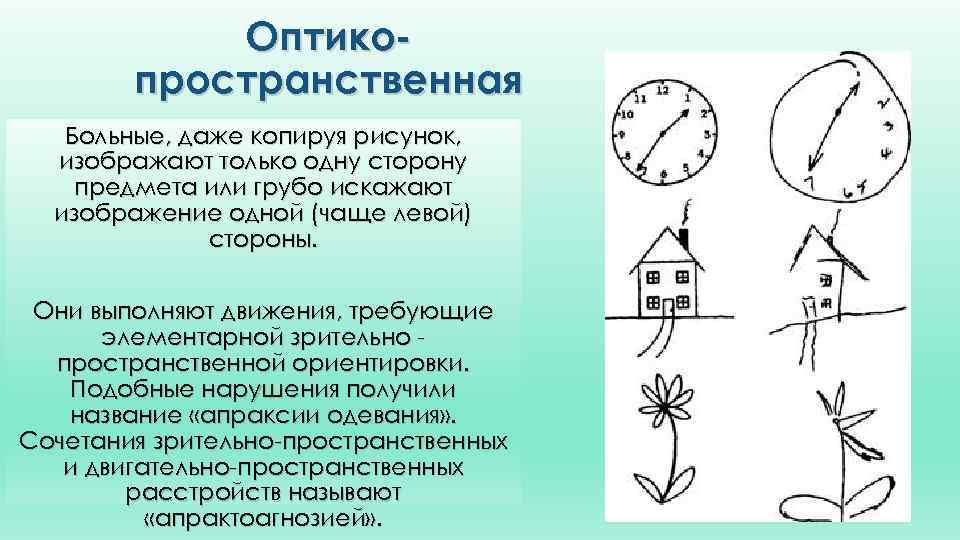 Оптикопространственная Больные, даже копируя рисунок, изображают только одну сторону предмета или грубо искажают изображение