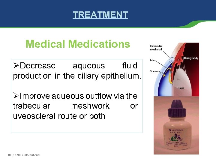 TREATMENT Medical Medications ØDecrease aqueous fluid production in the ciliary epithelium. ØImprove aqueous outflow