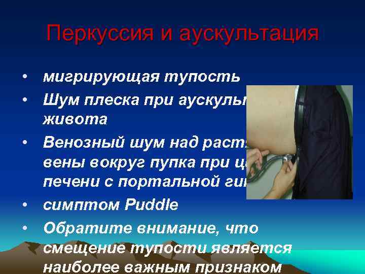 Перкуссия и аускультация • мигрирующая тупость • Шум плеска при аускультации живота • Венозный